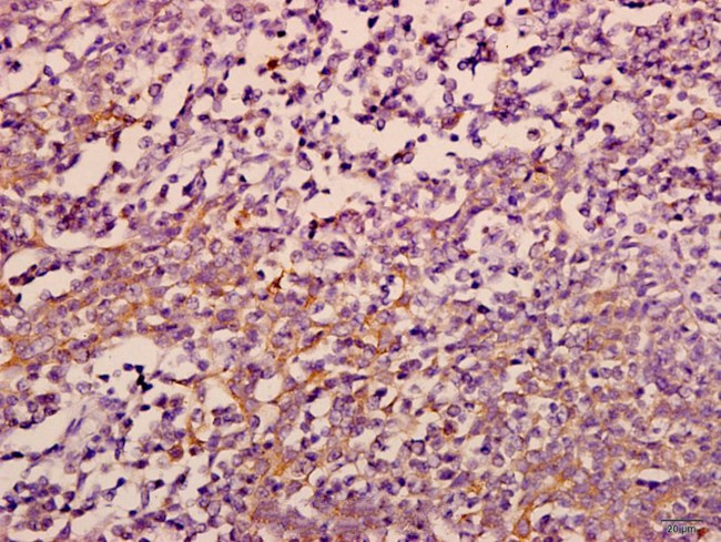 eIF3f Antibody in Immunohistochemistry (Paraffin) (IHC (P))