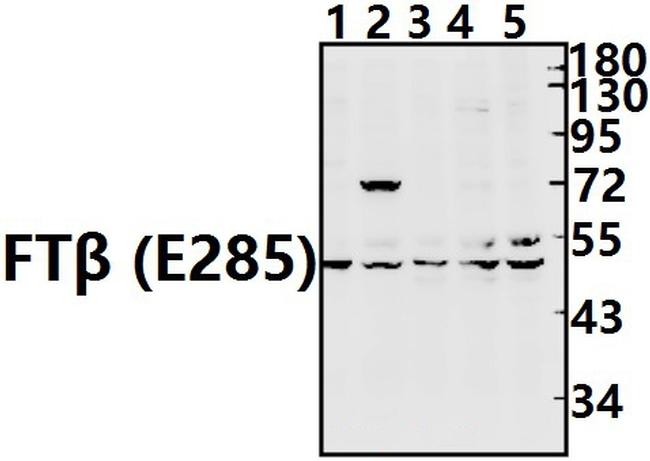 FNTB Antibody in Western Blot (WB)