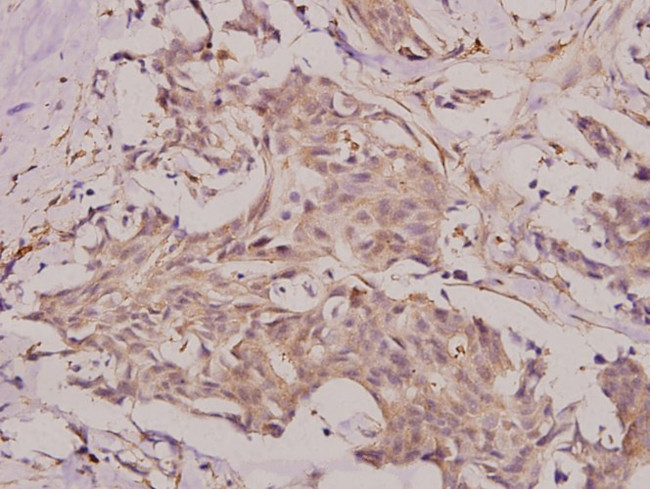 BMP-6 Antibody in Immunohistochemistry (Paraffin) (IHC (P))