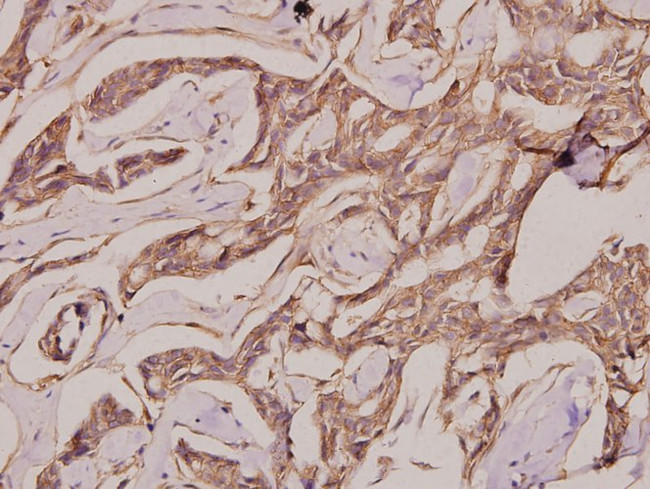 IGHG1 Antibody in Immunohistochemistry (Paraffin) (IHC (P))