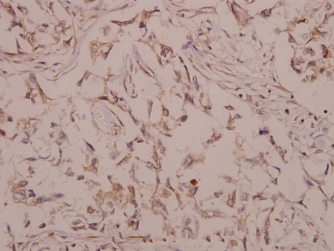 BMP-5 Antibody in Immunohistochemistry (Paraffin) (IHC (P))