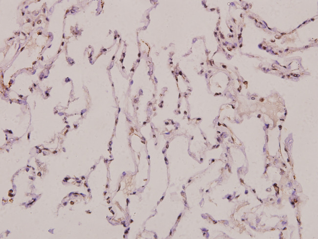 ATP5J2 Antibody in Immunohistochemistry (Paraffin) (IHC (P))