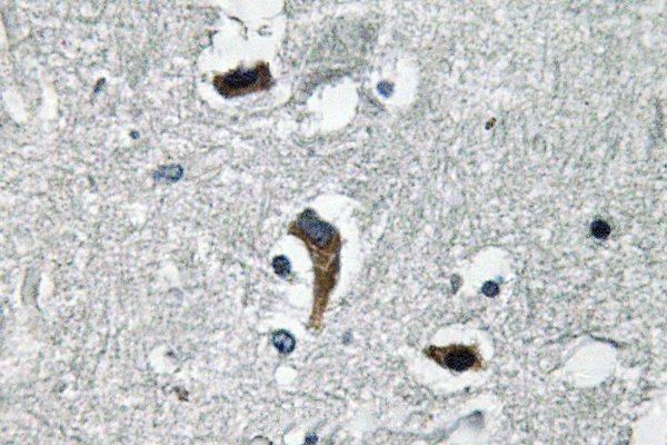 KCNMB4 Antibody in Immunohistochemistry (Paraffin) (IHC (P))