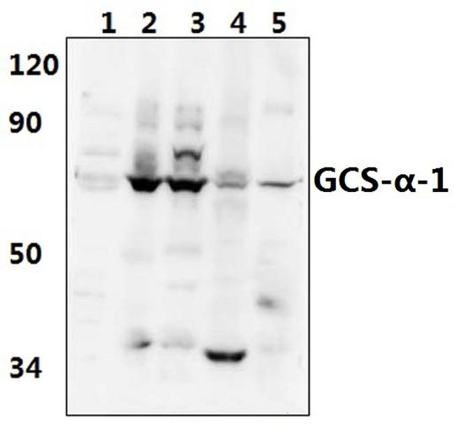 GUCY1A3 Antibody in Western Blot (WB)