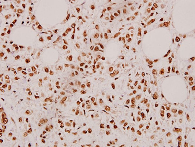 Cardiotrophin 1 Antibody in Immunohistochemistry (Paraffin) (IHC (P))