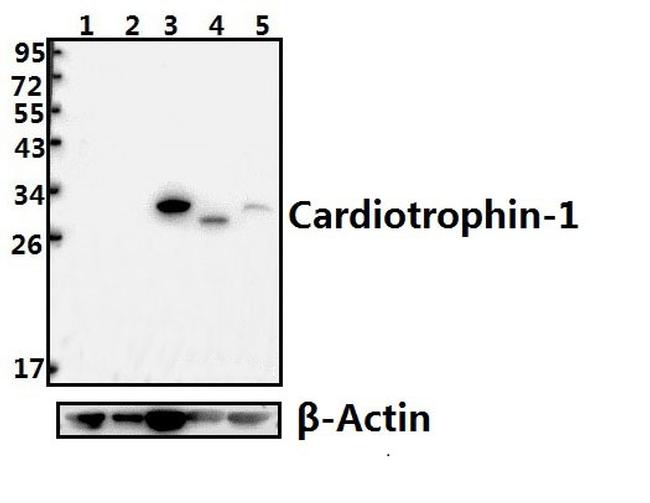 Cardiotrophin 1 Antibody in Western Blot (WB)