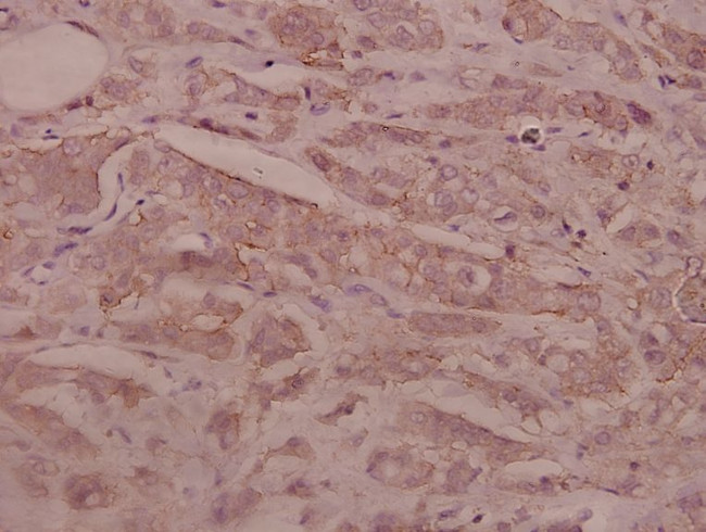 SEMA3C Antibody in Immunohistochemistry (Paraffin) (IHC (P))