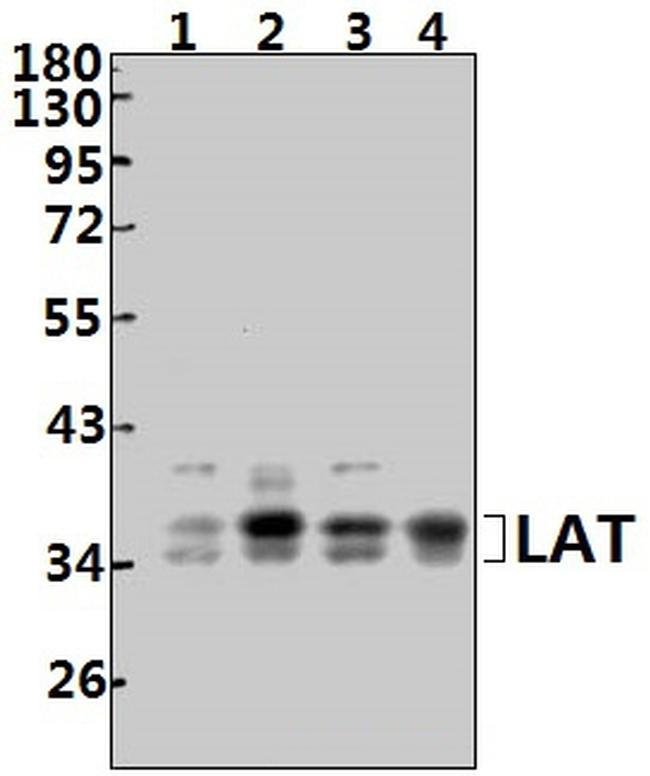 LAT Antibody in Western Blot (WB)