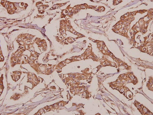 SLC25A6 Antibody in Immunohistochemistry (Paraffin) (IHC (P))