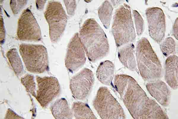 Neuromedin U-8 Antibody in Immunohistochemistry (Paraffin) (IHC (P))