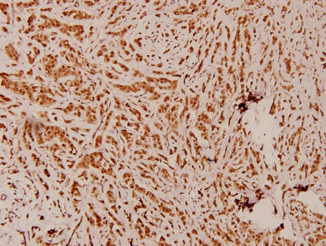 PEX14 Antibody in Immunohistochemistry (Paraffin) (IHC (P))