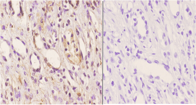 ABCD4 Antibody in Immunohistochemistry (Paraffin) (IHC (P))