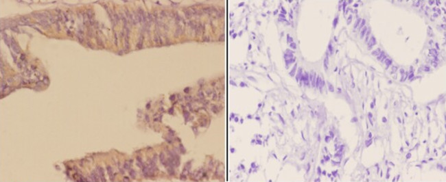 Arp3 Antibody in Immunohistochemistry (Paraffin) (IHC (P))