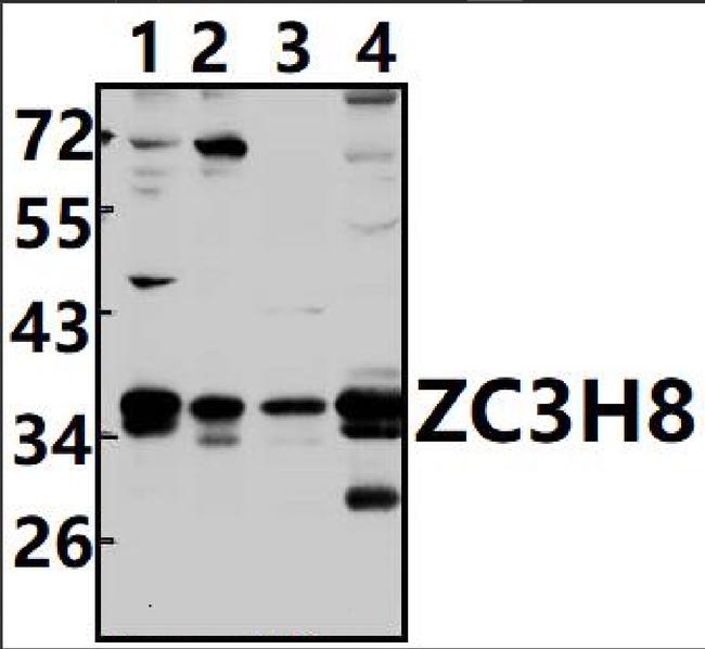 ZC3H8 Antibody in Western Blot (WB)