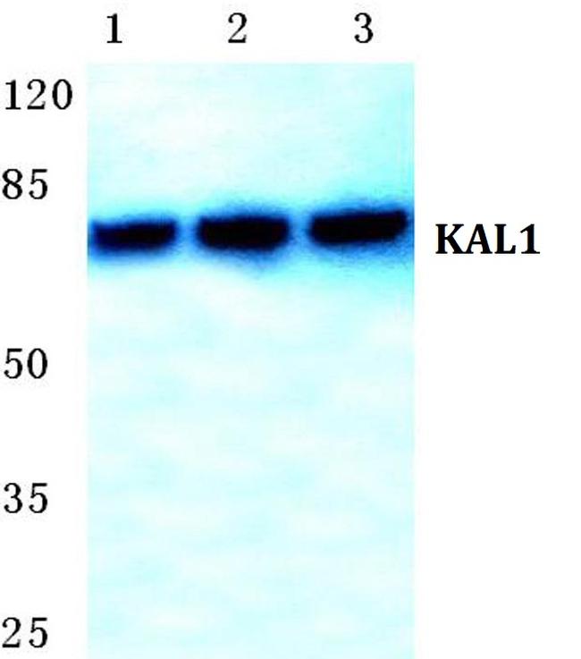 KAL1 Antibody in Western Blot (WB)