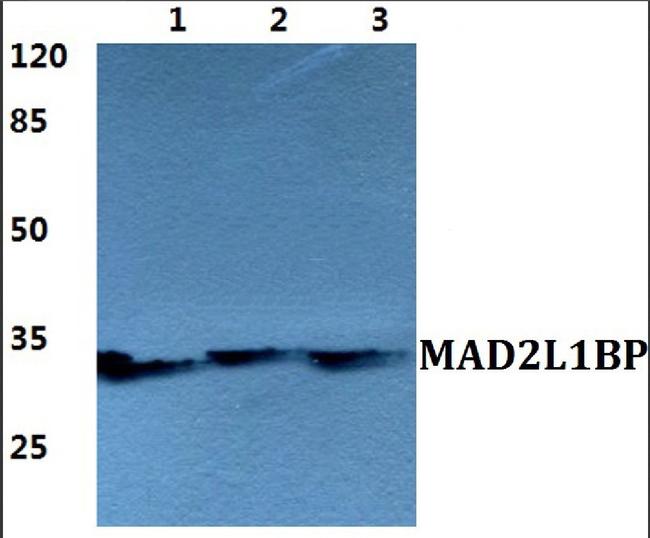 MAD2L1BP Antibody in Western Blot (WB)