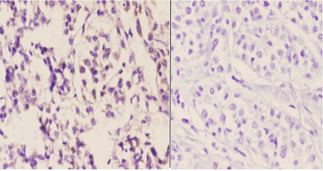 NDUFS1 Antibody in Immunohistochemistry (Paraffin) (IHC (P))