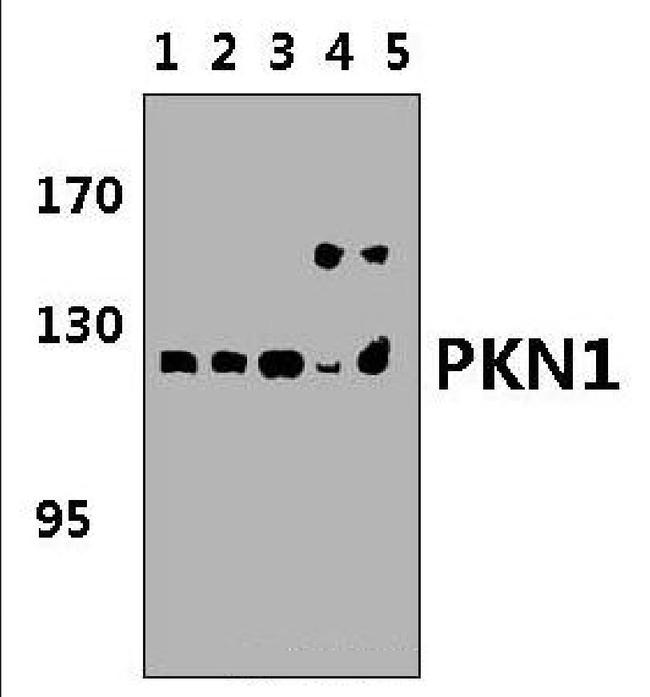 PKN1 Antibody in Western Blot (WB)