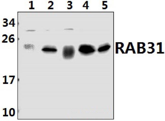 RAB31 Antibody in Western Blot (WB)