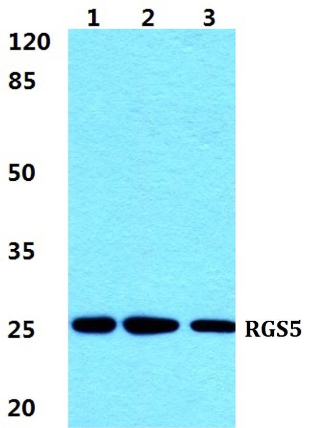 RGS5 Antibody in Western Blot (WB)