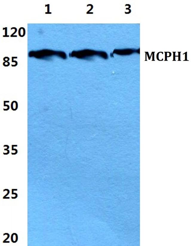 MCPH1 Antibody in Western Blot (WB)