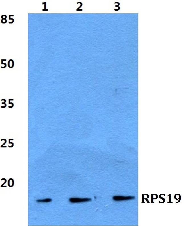 RPS19 Antibody in Western Blot (WB)