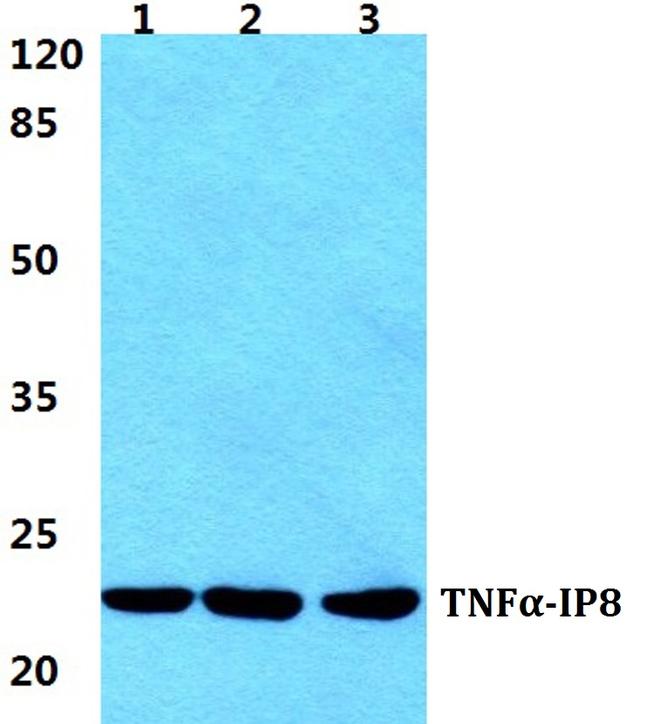 TNFAIP8 Antibody in Western Blot (WB)