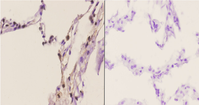 TRIP13 Antibody in Immunohistochemistry (Paraffin) (IHC (P))