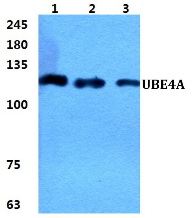 UBE4a Antibody in Western Blot (WB)