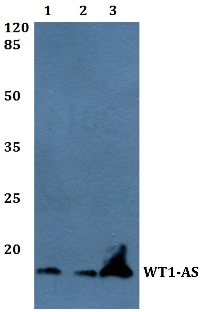 WT1-AS Antibody in Western Blot (WB)