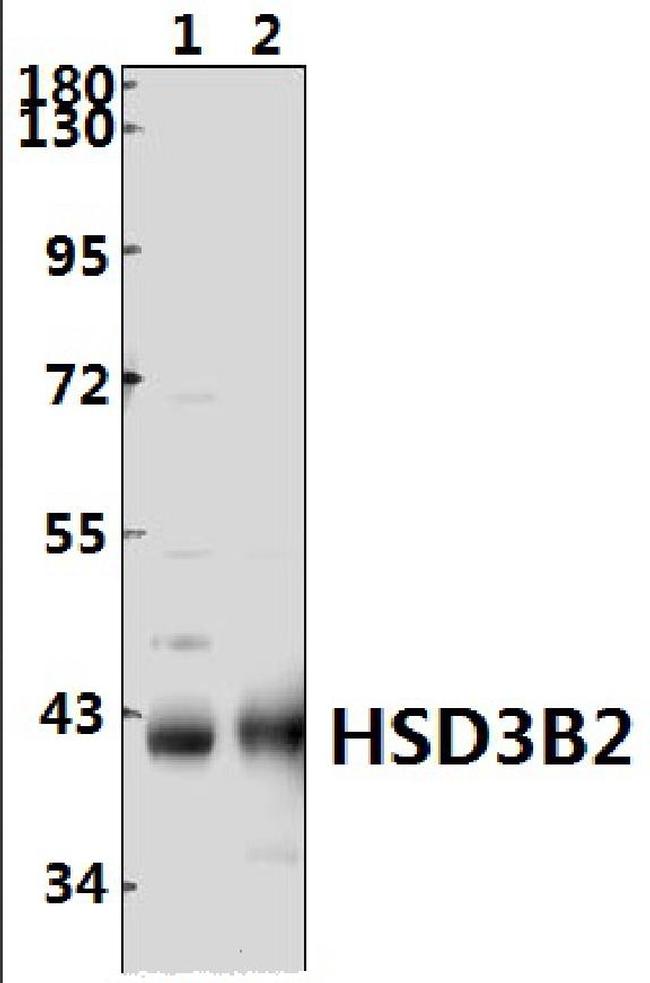 HSD3B2 Antibody in Western Blot (WB)