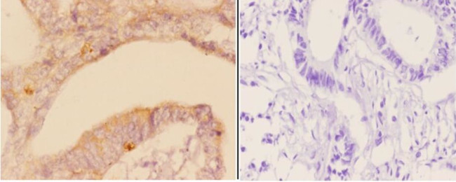 ADAM23 Antibody in Immunohistochemistry (Paraffin) (IHC (P))