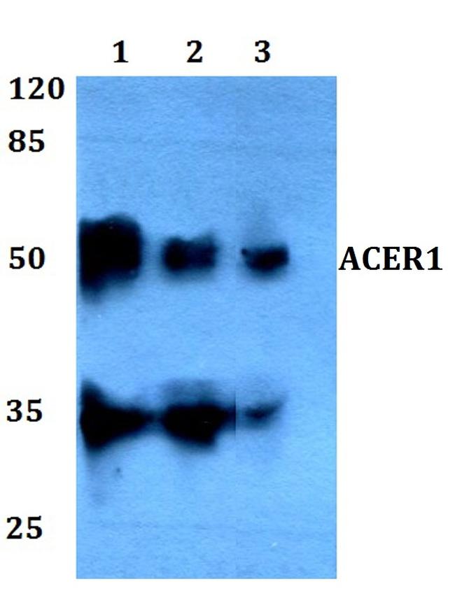 ASAH3 Antibody in Western Blot (WB)