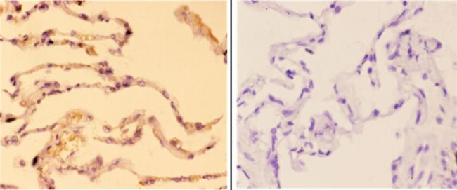 ABCC11 Antibody in Immunohistochemistry (Paraffin) (IHC (P))