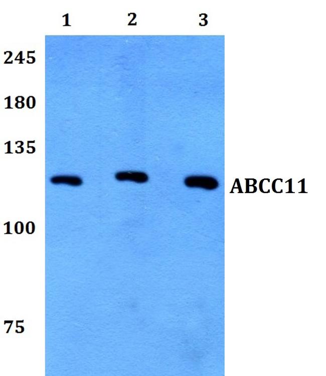 ABCC11 Antibody in Western Blot (WB)