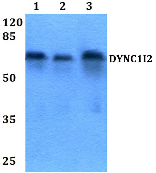 DYNC1I2 Antibody in Western Blot (WB)