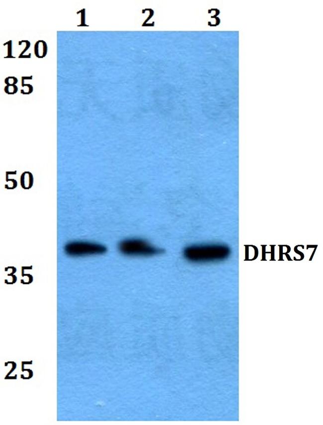 DHRS7 Antibody in Western Blot (WB)