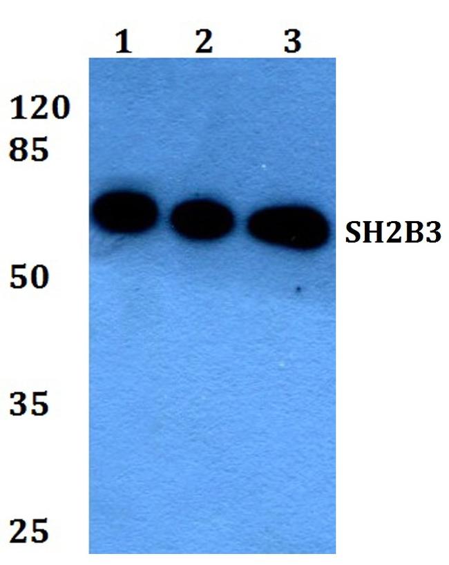 LNK Antibody in Western Blot (WB)