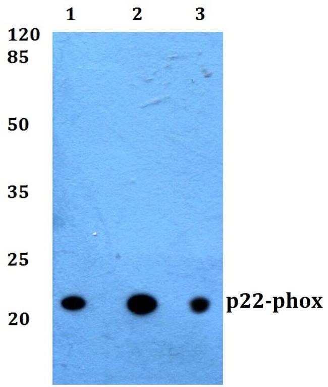 CYBA Antibody in Western Blot (WB)