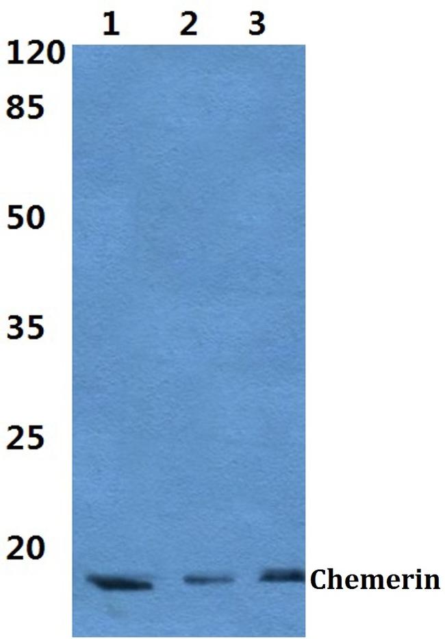 Chemerin Antibody in Western Blot (WB)