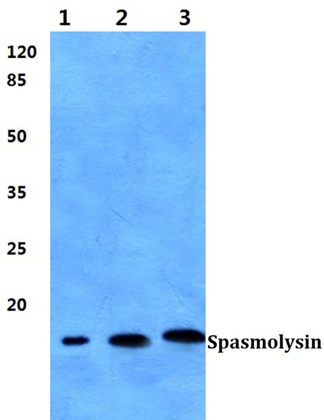 TFF2 Antibody in Western Blot (WB)