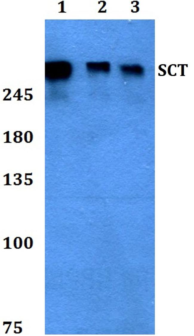 Secretin Antibody in Western Blot (WB)