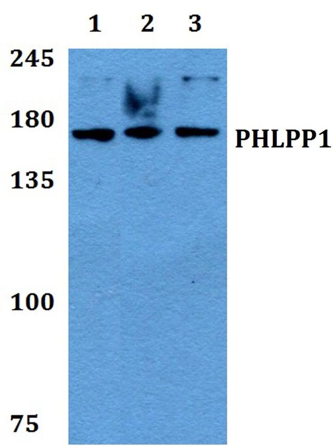 PHLPP1 Antibody in Western Blot (WB)