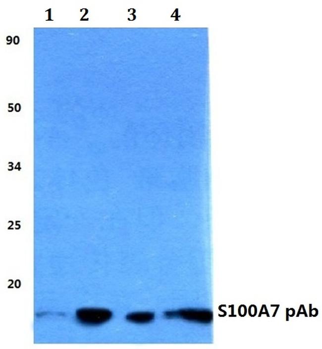 S100A7 Antibody in Western Blot (WB)