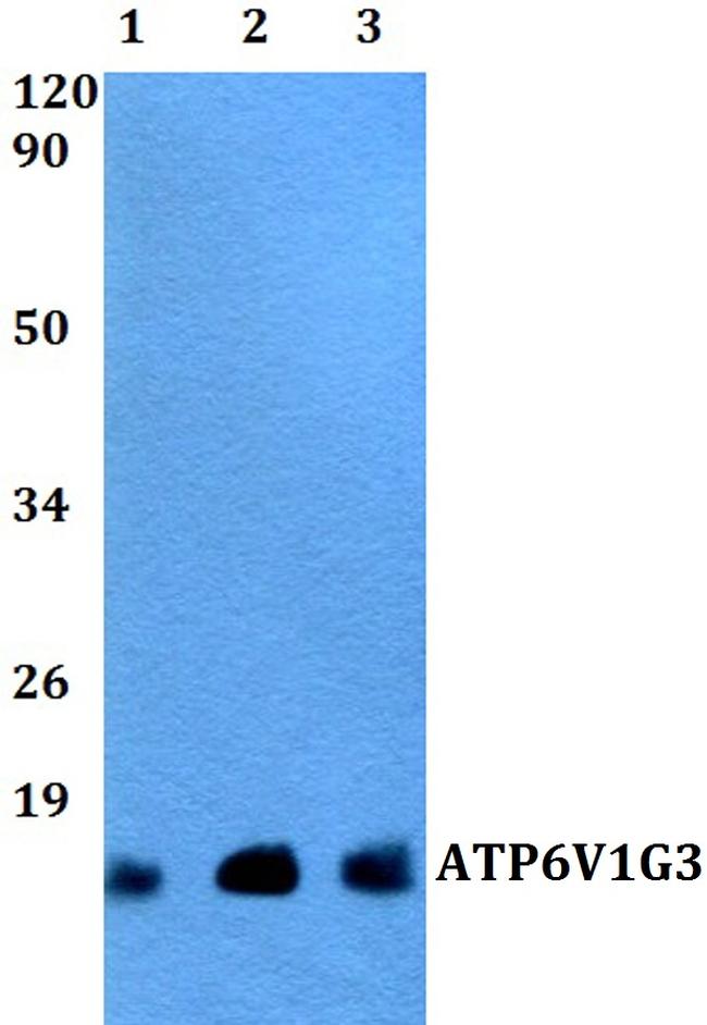 V-ATPase G3 Antibody in Western Blot (WB)
