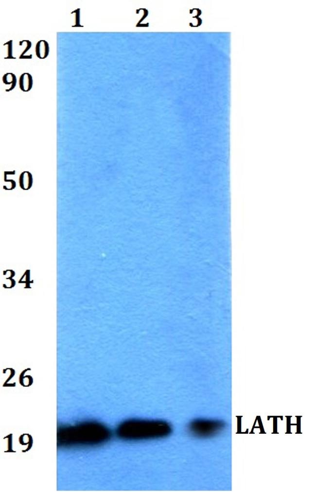 LATH Antibody in Western Blot (WB)