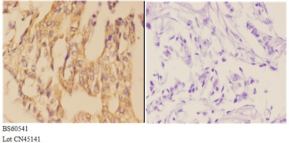 AANAT Antibody in Immunohistochemistry (Paraffin) (IHC (P))