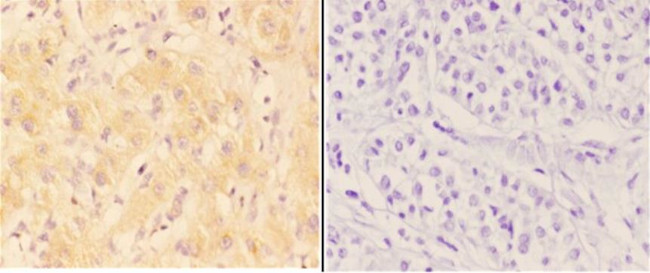 AANAT Antibody in Immunohistochemistry (Paraffin) (IHC (P))