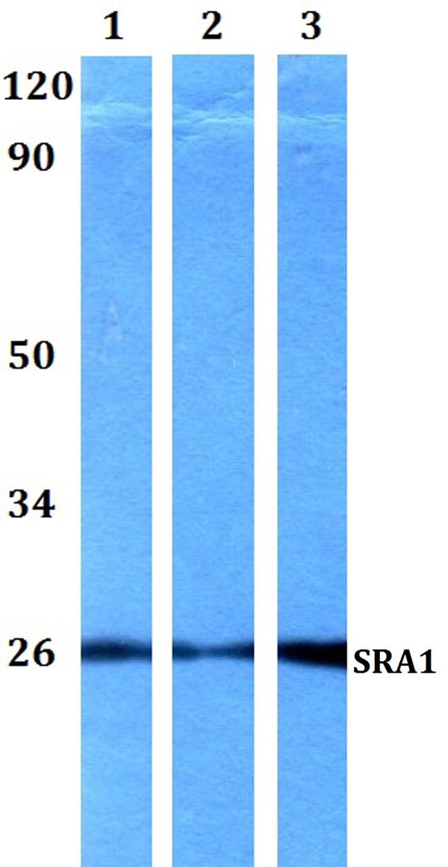 SRA1 Antibody in Western Blot (WB)