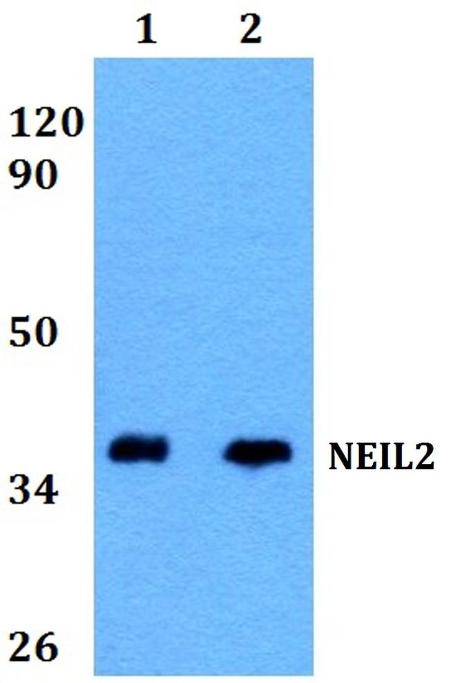 NEIL2 Antibody in Western Blot (WB)